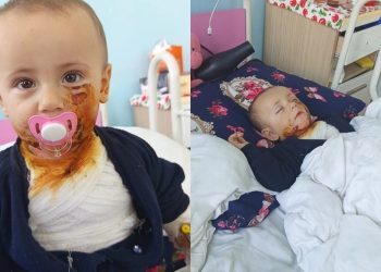 1 yaşlı Banu təcili əməliyyat olunmalıdır FOTO