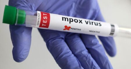 image-mpox-maymun-cicegi-reu-2270739_1