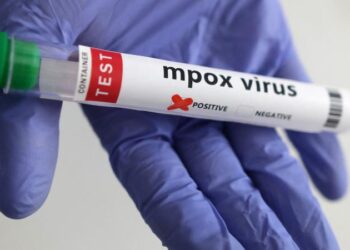 Meymunçiçəyi virusunun yeni bir ştammı müəyyən edilib