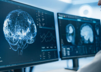 Alzheimerin erkən dəyişikliklərini bloklayan dərman kəşf edilib