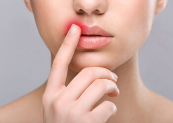 Alimlər herpes virusunun yoluxuculuğunun izahını tapdı