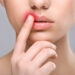 Alimlər herpes virusunun yoluxuculuğunun izahını tapdı