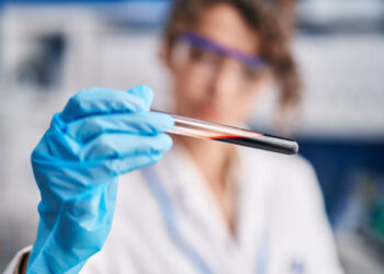 Alzheimerin erkən diaqnozuna maneə aradan qaldırıldı