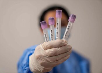 İspaniyada hantavirus şübhəsi ilə bir nəfər xəstəxanaya yerləşdirilib