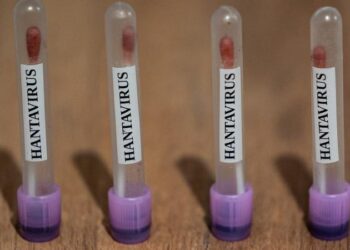 ABC: ABŞ hantavirus hallarını “3-cü səviyyəli təcili yardım” kodu ilə izləyir