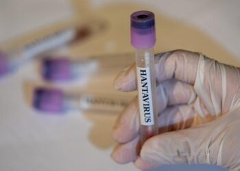 ÜST: Ölkələr yeni hantavirus hallarına hazır olmalıdır