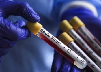 Ölümcül Ebola virusu xəbərdarlığı artır! Ölüm sayı 100-ü keçdi!