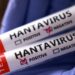 Dünyanı dəhşətə salan Hantavirus gəmisi yenidən yelkənə çıxdı