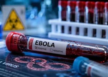 Konqo DR və Uqandada Ebola qızdırmasından ölənlərin sayı 1 000 nəfəri keçib