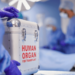 Nazirlər Kabineti donor orqanların transplantasiyası ilə bağlı siyahıda dəyişiklik edib