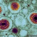 Alimlər yeni təhlükəli virus aşkarlayıblar